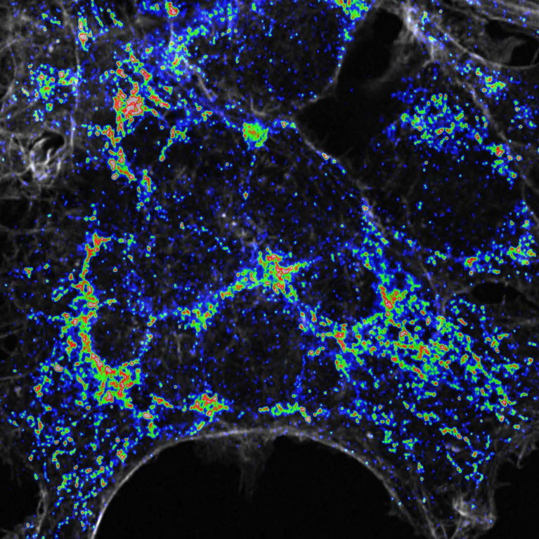 Mitochondria in the cell during metabolic stress. High increases in the number of mitochondria (red), medium increases (green), and low increases (blue).