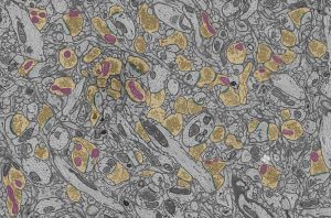 Imagen de microscopía electrónica de neuronas en el cerebro que muestra los botones presinápticos (amarillo), las mitocondrias (púrpura) y las sinapsis (azul).