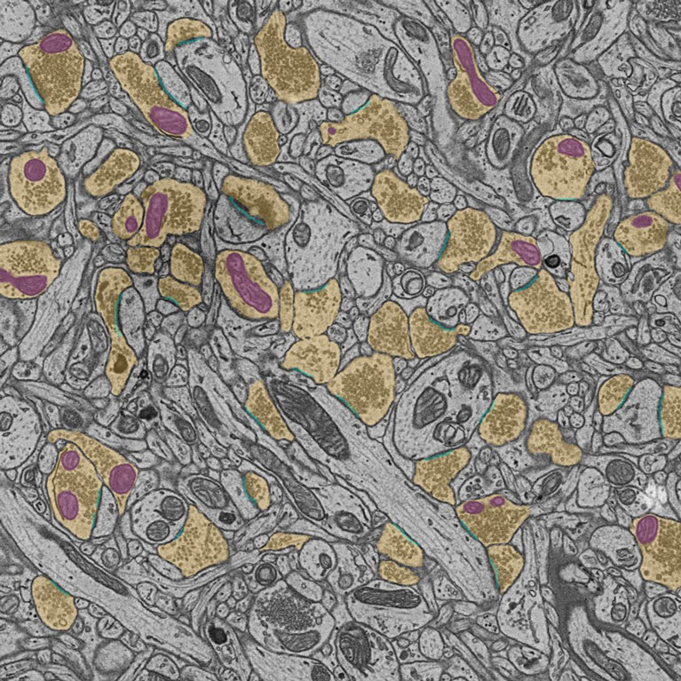 : Elektronenmikroskopische Aufnahme von Neuronen im Gehirn, die die präsynaptischen Boutons (gelb), Mitochondrien (lila) und Synapsen (blau) zeigt.