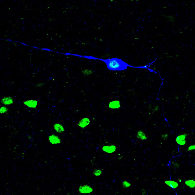 Se identificó una neurona mecánica que responde a la picazón (azul) ubicada entre los núcleos celulares (verde) en el tronco encefálico.