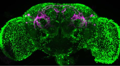 Un cerebro de mosca de la fruta que muestra neuronas taquiquininérgicas específicas de macho (magenta), que producen el neuropéptido taquiquinina, y neuronas que expresan TkR86C (verde), que reciben taquiquinina.