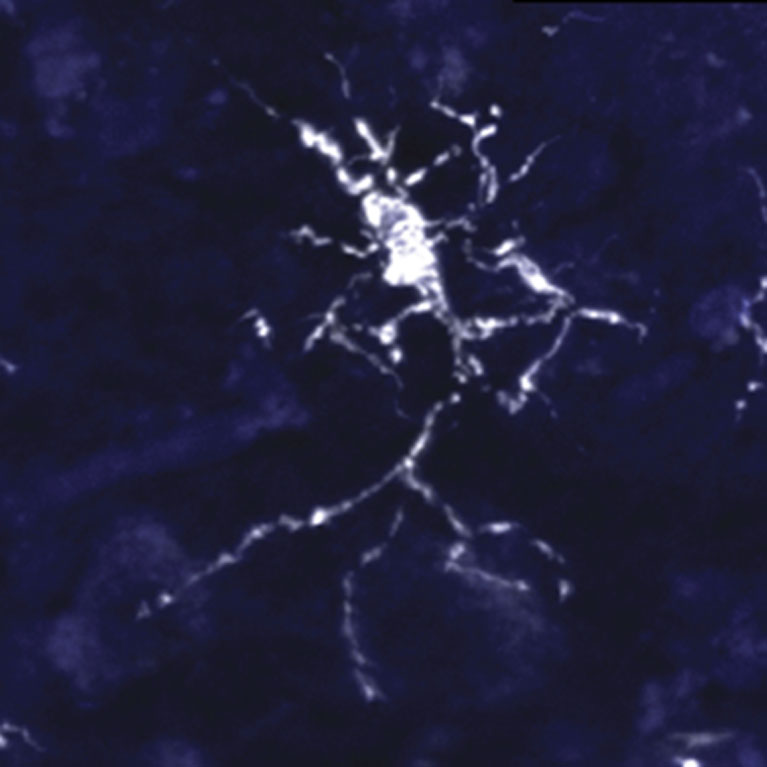 An immune brain cell (microglia) in a human brain.
