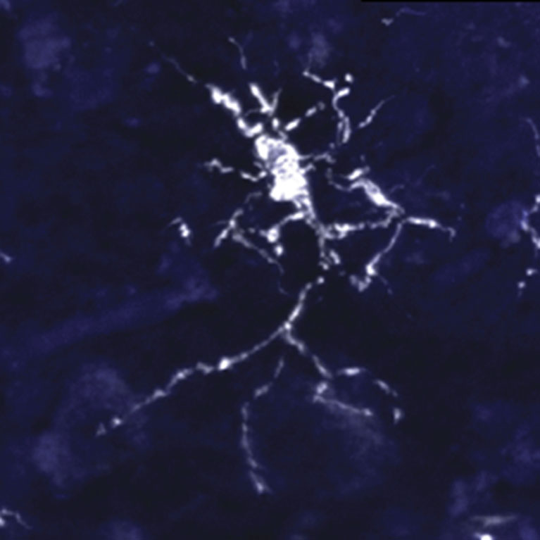 Een immuunhersencel (microglia) in een menselijk brein.