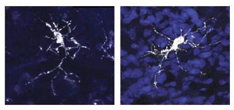 Izquierda: una célula cerebral inmune (microglía) en un cerebro humano. Derecha: Microglia en el nuevo modelo organoide con un entorno similar al del cerebro humano. Las células son casi indistinguibles.