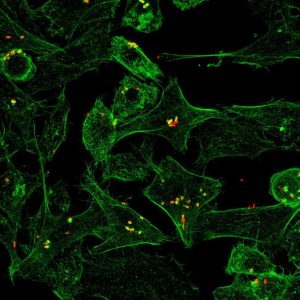 Cellules (vertes) infectées par des bactéries (rouges).