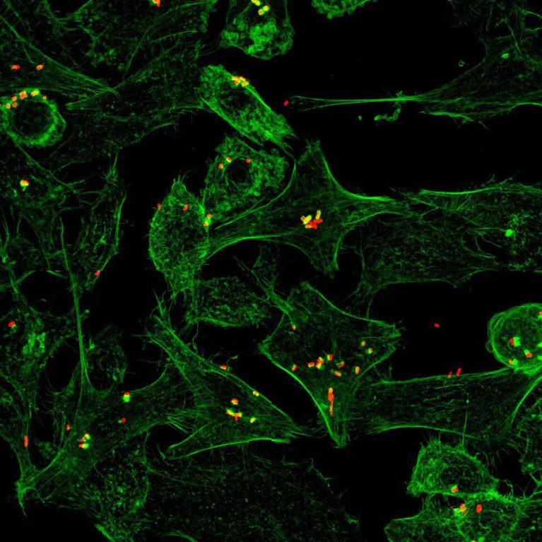 Cells (green) becoming infected with bacteria (red).