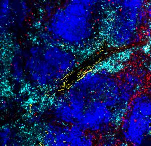 Exhausted killer T cells with higher expression of the noradrenaline receptor ADRB1 (cyan) surround sympathetic nerves (yellow) in a virally infected spleen. Killer T cells without ADRB1 (red) do not surround the sympathetic nerves (yellow).