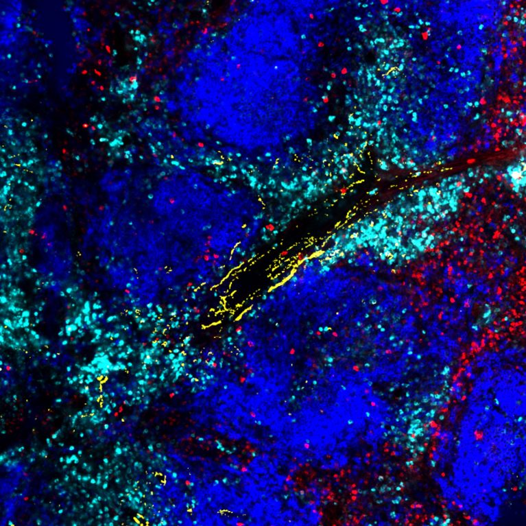 Exhausted killer T cells with higher expression of the noradrenaline receptor ADRB1 (cyan) surround sympathetic nerves (yellow) in a virally infected spleen. Killer T cells without ADRB1 (red) do not surround the sympathetic nerves (yellow).