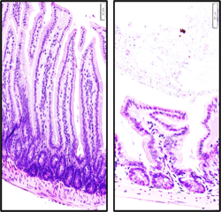 Los pliegues internos de los intestinos (púrpura) son diferentes en ratones sanos (izquierda) en comparación con los ratones alimentados con una dieta rica en grasas (derecha). Los investigadores de Salk identificaron cambios en las bacterias y los ácidos biliares que impulsan estos cambios.