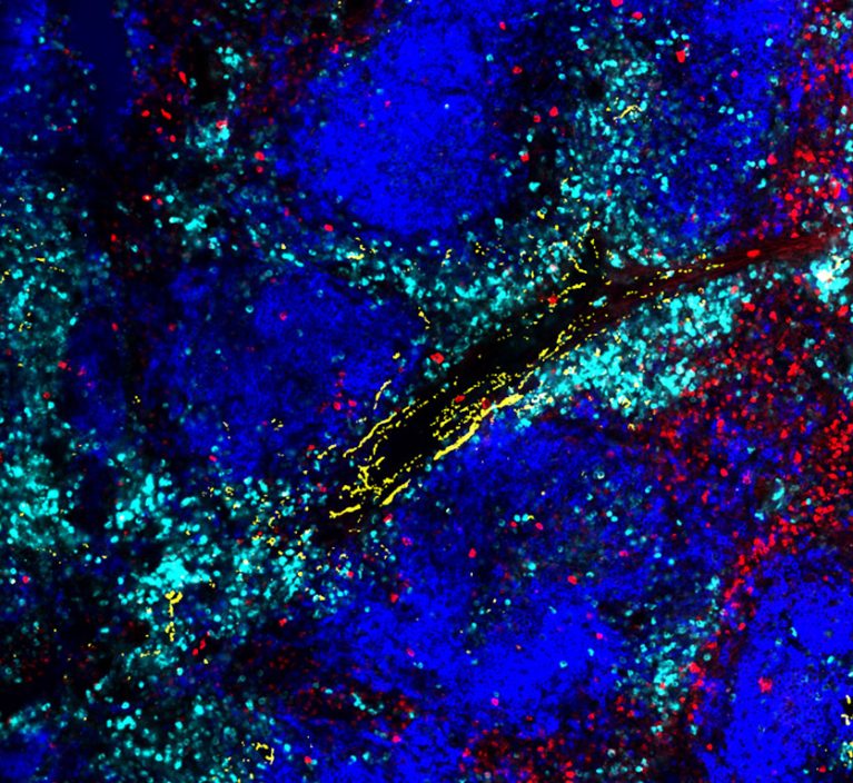 Exhausted killer T cells with higher expression of the noradrenaline receptor ADRB1 (cyan) surround sympathetic nerves (yellow) in a virally infected spleen. Killer T cells without ADRB1 (red) do not surround the sympathetic nerves (yellow)