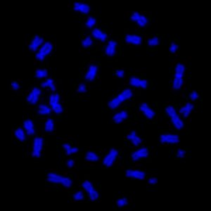 A metaphase spread of chromosomes (blue).