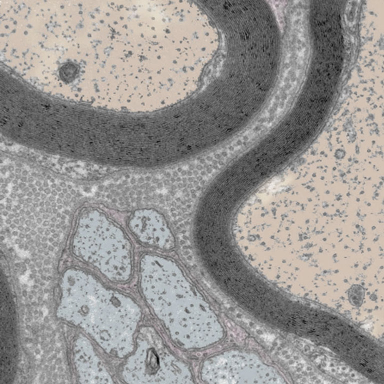 Cross-section of mouse sciatic nerves.