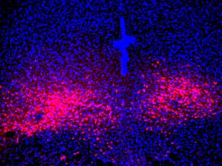 PAC1R-expressing dorsal raphe neurons in the mouse brain (red) serve as the projection targets for PACAP parabrachial neurons to mediate panic-like behavioral and physical symptoms.