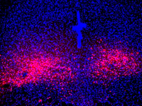 Las neuronas dorsales del rafe que expresan PAC1R en el cerebro del ratón (rojo) sirven como objetivos de proyección para las neuronas parabraquiales PACAP para mediar síntomas físicos y de comportamiento similares al pánico.