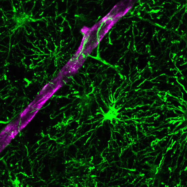 Menselijke astrocyten (groen) verlengen processen die zich rond het bloedvat van de gastheer wikkelen (magenta).