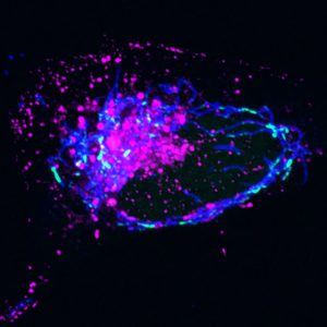 Endosomes (magenta) collect around mitochondria (blue) after infection with virus HSV-1, which attacks mtDNA (green) and causes its release