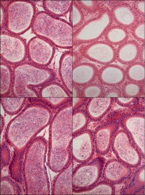 Sperm, pictured inside the cross-sectioned tube of the epididymis, were not generated while mice took the HDAC inhibitor drug (top right), but after 60 days off the drug, spermatogenesis was recovered (bottom right). The left column shows sperm at the same time points in a mouse that did not receive the drug.