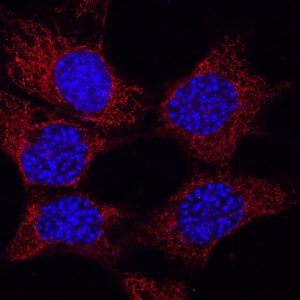 Cellule neuronali di topo con mitocondri (rossi) e nuclei (blu).