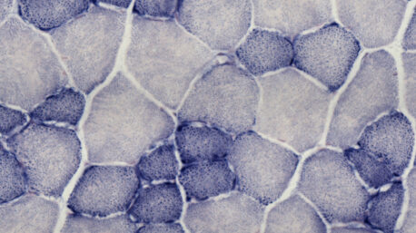 A cross-section of mouse muscle tissue showing individual muscle fibers and their mitochondria (blue).