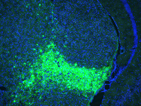 CGRP-expressing neurons (green) in the parvocellular subparafascicular nucleus (SPFp) of the thalamus.