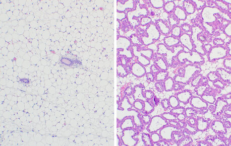 Virgin (left) and lactating (right) mouse mammary gland imaging shows the dramatic structural changes that occur to facilitate milk production, including cell proliferation and the formation of milk ducts.