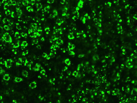 Mouse fat cells filled with lipid droplets (green).