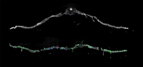 Cross-section of Arabidopsis leaf under drought conditions (top) and after 15 minutes of rehydration (bottom). Each color (blue, pink, green) represents a different recovery-induced gene being expressed.