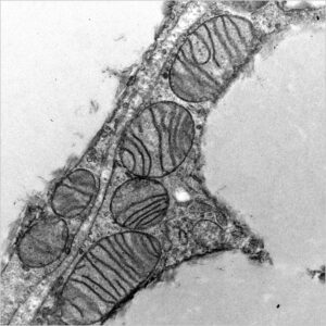 Mitochondria in the fat tissue of mice unable to produce SLC35A4-MP, causing the mitochondria to be structurally compromised and dysfunctional.