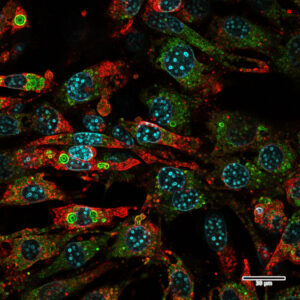 Mature brown fat cells in mice show SLC34A4-MP (red), DNA (blue), and mitochondria (green).