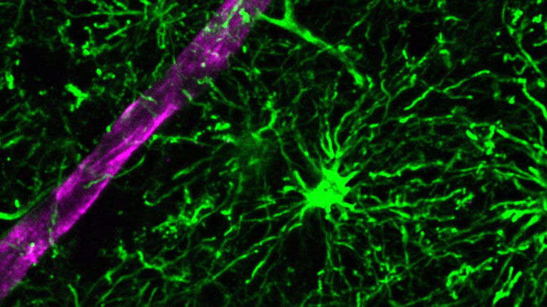 Alzheimer's News