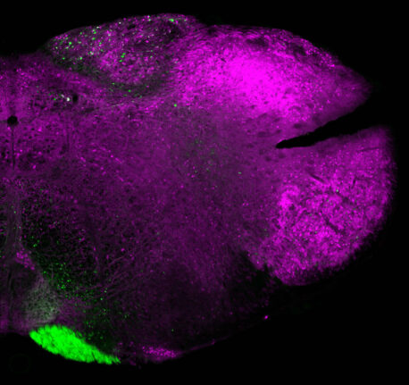 Somatostatin neurons (magenta) and projection neurons to the thalamus (green).