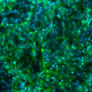 Jesse Dixon, MD, PhD, and Tessa Popay, PhD, used human iPSC-derived cardiomyocytes to find that the dynamic 3D structure of the genome influences cell identity.