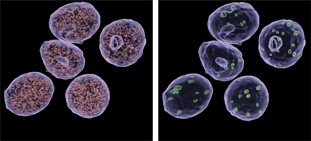 Small (left) and large (right) condensates of the mediator complex inside nuclei of a pancreatic beta cell-derived cell line. Salk researchers discovered that GLP-1s interact with the multi-protein complex called Mediator to cause a broad genomic response. 