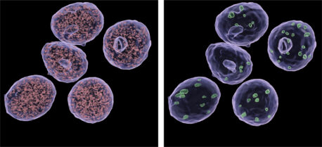 How do GLP-1 agonists affect gene expression? - Salk Institute for ...