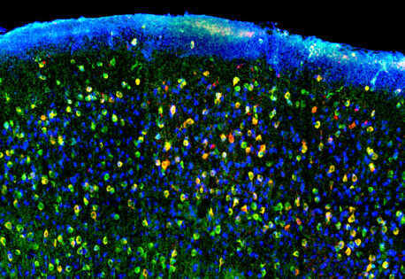 Mouse brain tissue showing inhibitory neurons labeled with a red fluorescent VIS-Fb that binds to the green calcium biosensor. Neurons are highlighted in blue.