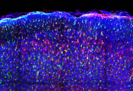 Mouse brain tissue showing astrocytes labeled with a red fluorescent VIS-Fb that binds to the green calcium biosensor. Astrocytes are highlighted in purple, while neurons are shown in blue, illustrating cell-type-specific labeling.