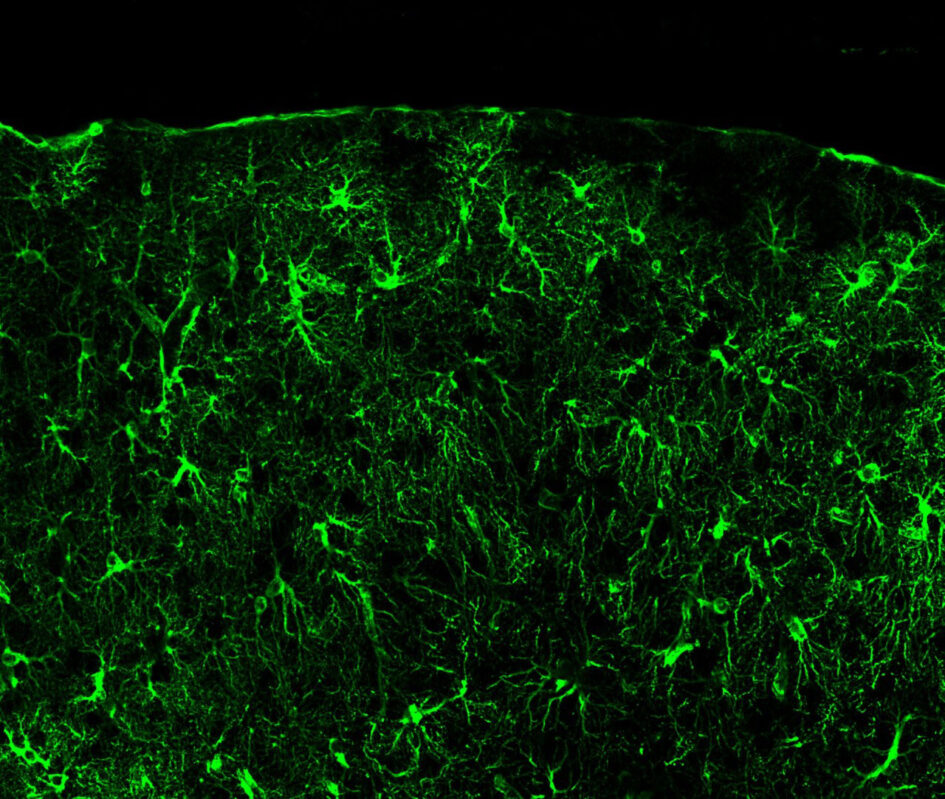 Astrocytes in the brain’s visual cortex. New Salk research shows that astrocytes may be a viable target for future fragile X syndrome therapeutics and emphasizes the importance of studying these specialized brain cells in disease and disorder research.