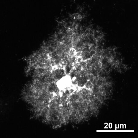 A single astrocyte imaged to showcase the star-like branching of the cell. New Salk research shows that astrocytes may be a viable target for future fragile X syndrome therapeutics and emphasizes the importance of studying these specialized brain cells in disease and disorder research.