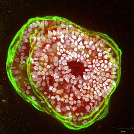 Healthy pancreas organoids that have been turned inside out to study their secretion. Each cell nuclei is white and the “edges” of the organoid that would typically be inward facing but now face outward are green.