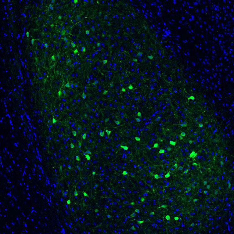 Isolation drives alcohol consumption through brain circuit that differs by sex