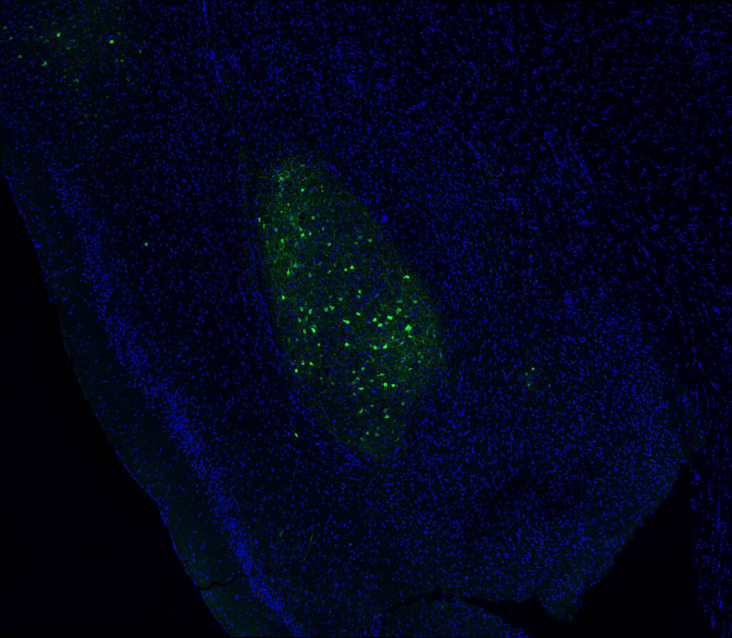 Mouse basolateral amygdala (green) neurons projecting to the prefrontal cortex, which Salk Institute scientists discovered is part of a circuit that controls alcohol drinking in response to social isolation.