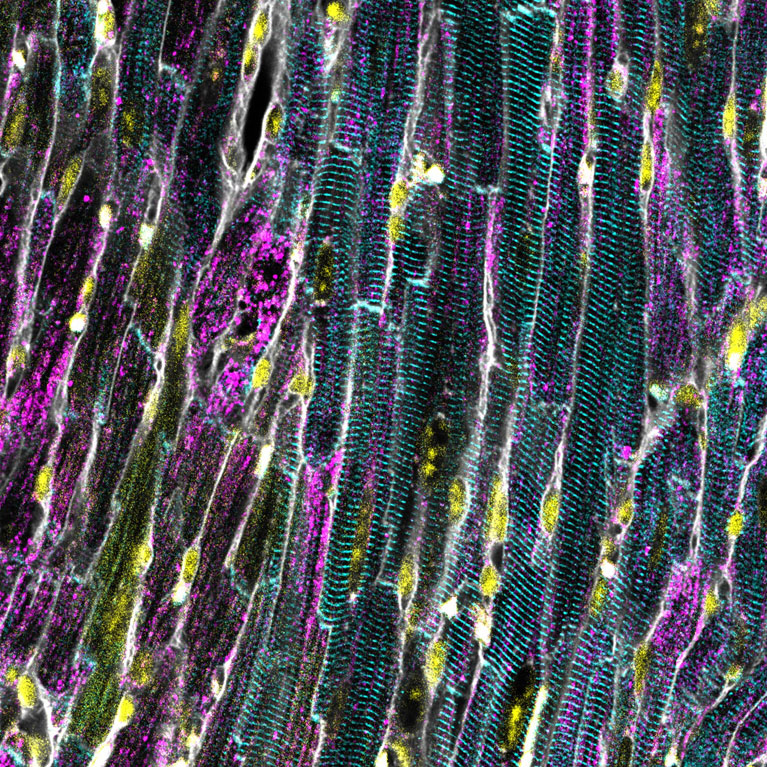 How can stressed mitochondria actually protect your heart?