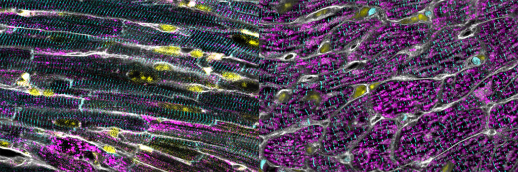 Inducing mitohormesis in mice protects heart mitochondria (magenta) from damage induced by the chemotherapeutic drug doxorubicin (right) compared to littermate controls (left). Cell membranes are labeled in gray, and nuclei in yellow. Inducing mitohormesis in mice protects heart mitochondria (magenta) from damage and loss induced by the chemotherapeutic drug doxorubicin (right) compared to littermate controls (left). Heart muscle cells are outlined in gray (using a stain for membranes) and nuclei are yellow (visualized using a stain for DNA).