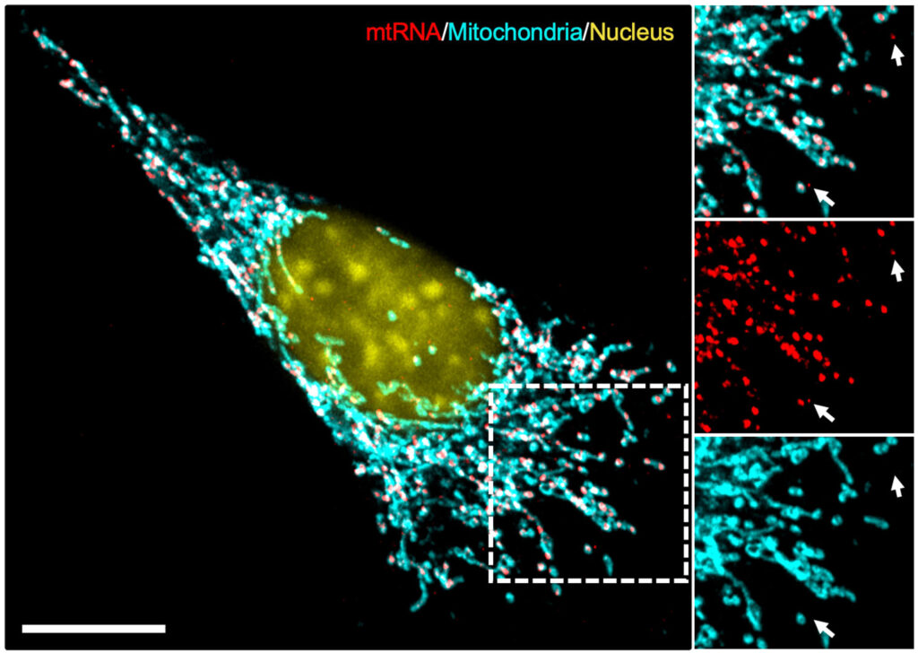 Representative images showing mitochondrial RNA (mtRNA) transcripts (red) present outside of the confines of mitochondria (cyan) in a melanoma cell following chronic interferon II exposure. Arrows point to specific examples of mtRNA outside the mitochondria. Representative images showing mitochondrial RNA (mtRNA) transcripts (red) present outside of the confines of mitochondria (cyan) in a melanoma cell following chronic interferon II exposure. Arrows point to specific examples of mtRNA outside the mitochondria.