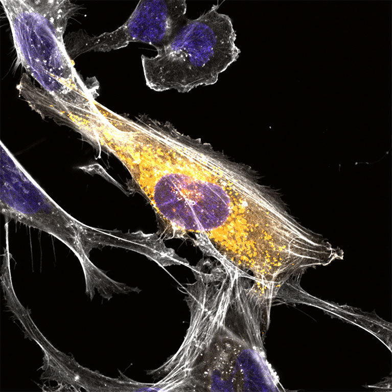 Microproteins provide new playbook for Alzheimer’s research
